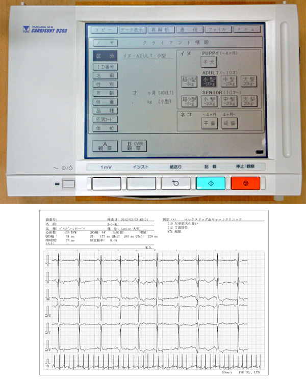 解析機能付心電計